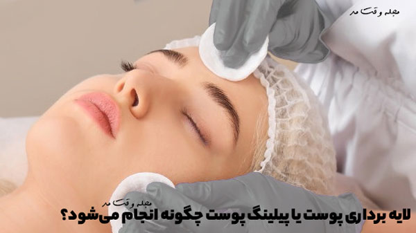 How is skin exfoliation or skin peeling done?