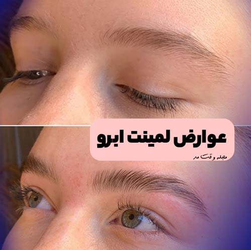 A picture before and after eyebrow lamination
