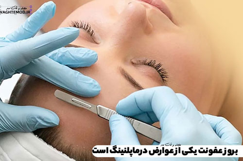 Risks and complications of dermaplaning