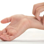 Itchy skin, cause of itchy skin and treatment of itchy skin