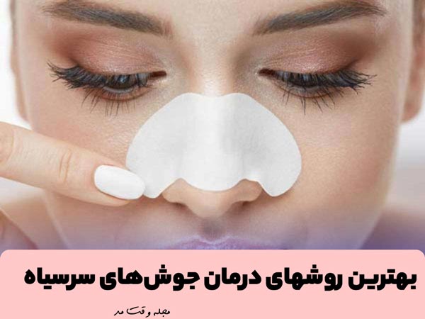 Treatme of blackheads with masks
