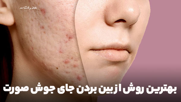You can see the difference between a healthy face and a face with pimples and acne.
