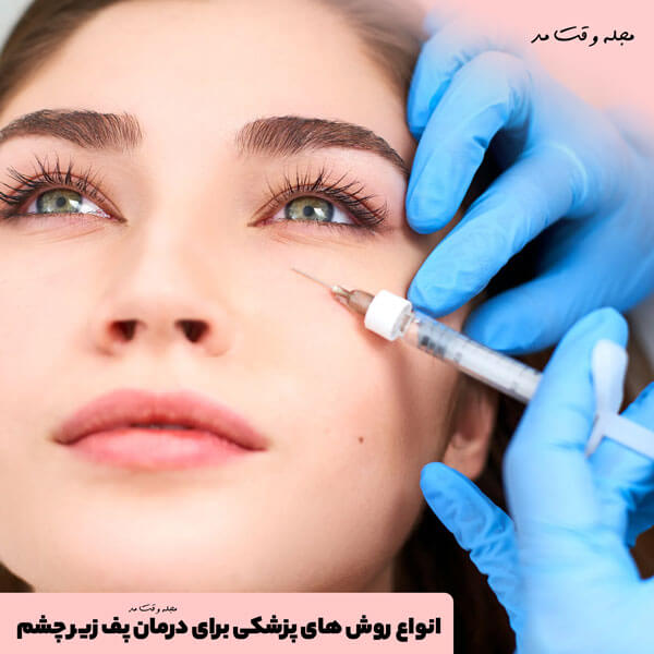 Various medical methods to treat puffiness under the eyes