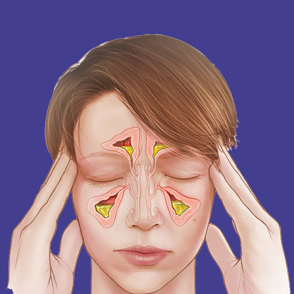 The strongest aibiotic for chronic and acute sinusitis