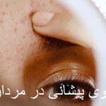 What is a pimple on the forehead?