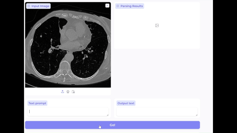 BiomedParse artificial intelligence