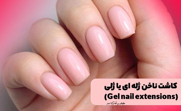 A model of gel nail implantation, one of the types of nail implantation in Iran