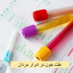 Causes of blood in men's urine