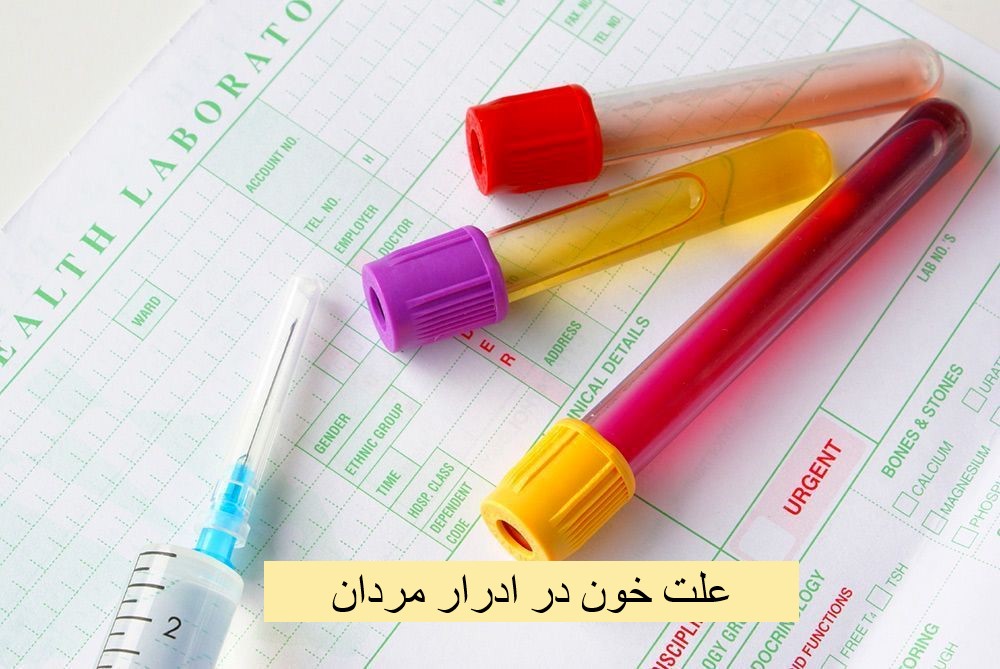 Causes of blood in men's urine
