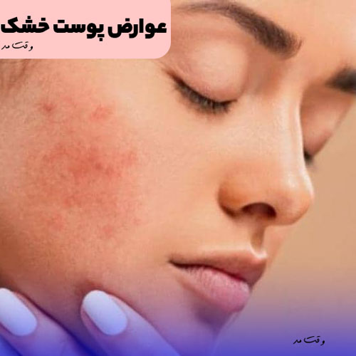 You see the complications and diseases caused by dry skin.