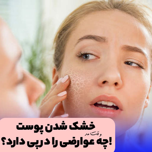 A disease caused by dry facial skin