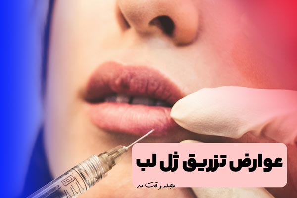 Lip gel injection and its side effects