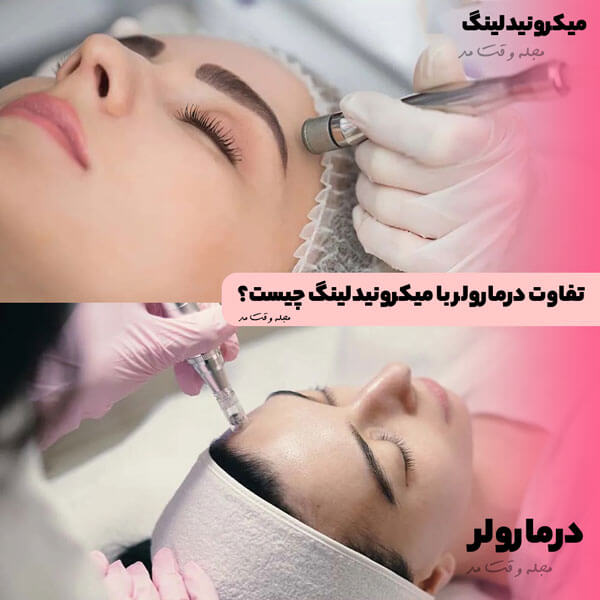 The difference between dermaroller and microneedling