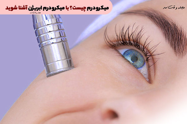 Get to know microdermabrasion in Time Magazine