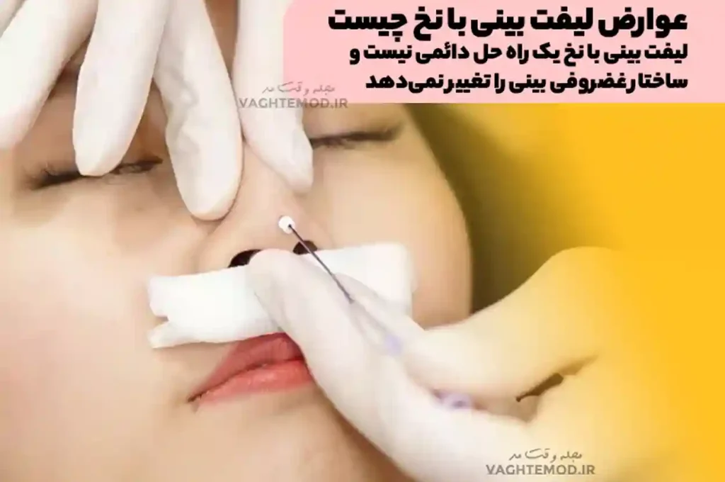 Complications of nose lift with thread