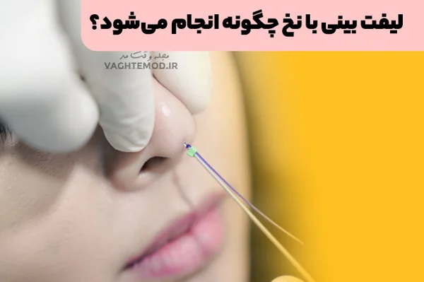 How is a nose lift performed with thread?