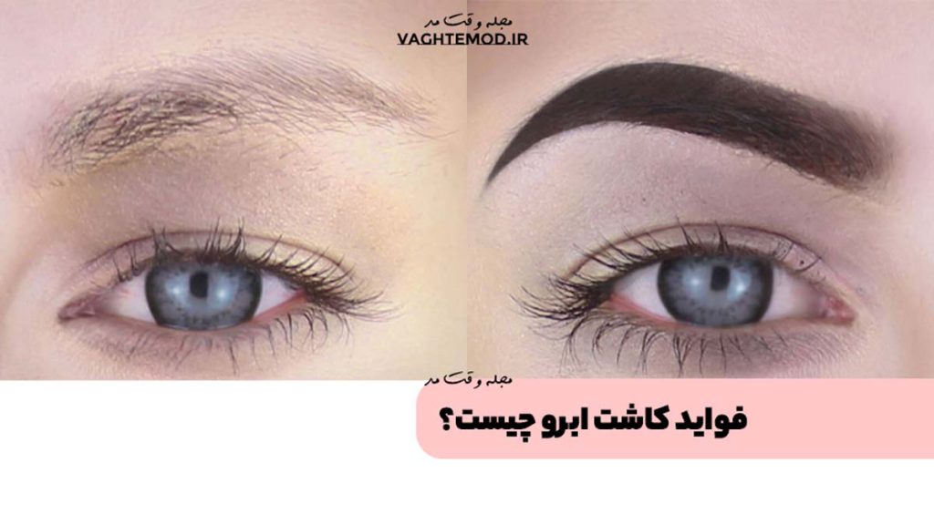 What are the benefits of eyebrow transpla?