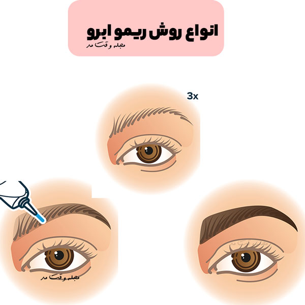 Remo Eyebrow methods