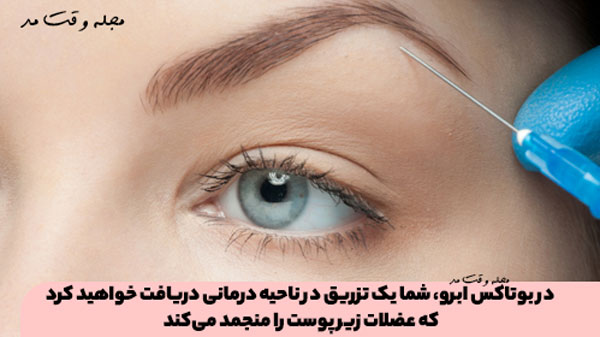 In Botox Eyebrow, you will receive an injection in the treatme area, which freezes the muscles under the skin