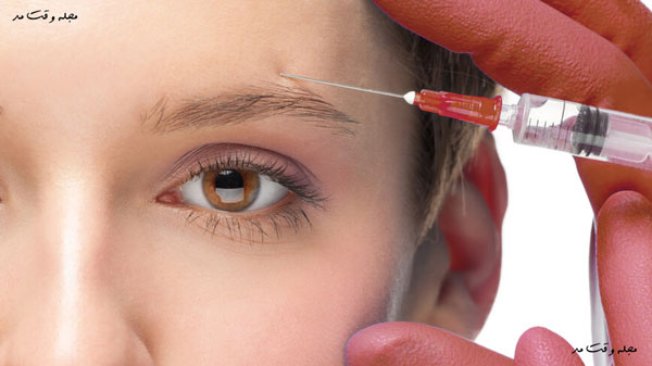 Steps to do the Botox eyebrow