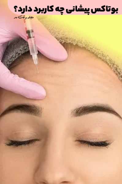 Forehead Botox is used to eliminate forehead wrinkles and wrinkles.