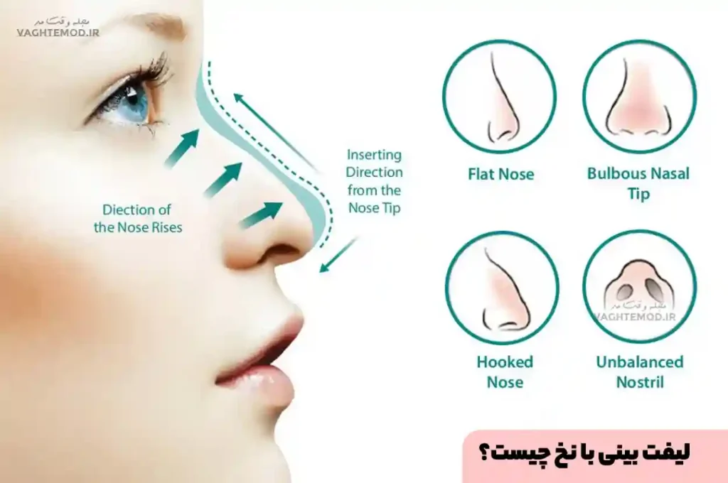 Rhinoplasty is a non-surgical, minimally invasive, reversible treatment with predictable results for people looking for a non-surgical alternative to their nose.