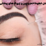 Botox helps treat frown lines and forehead wrinkles