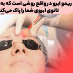 Remo Eyebrow is actually a way to clear your eyebrow tattoo