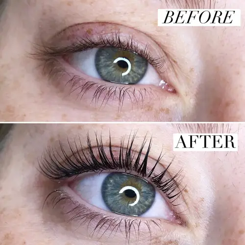 Photo before and after Botox eyelashes