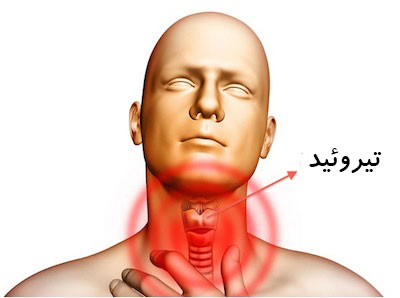 Inappropriate foods for low -work thyroid