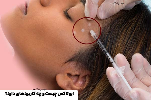 Botox temporarily paralyzes the muscles.
