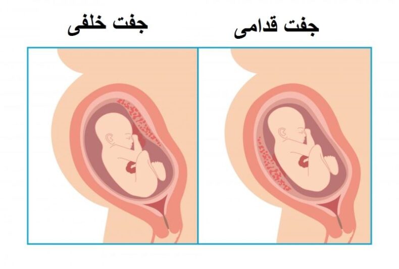 What is the difference between the posterior pair and the aerior pair?