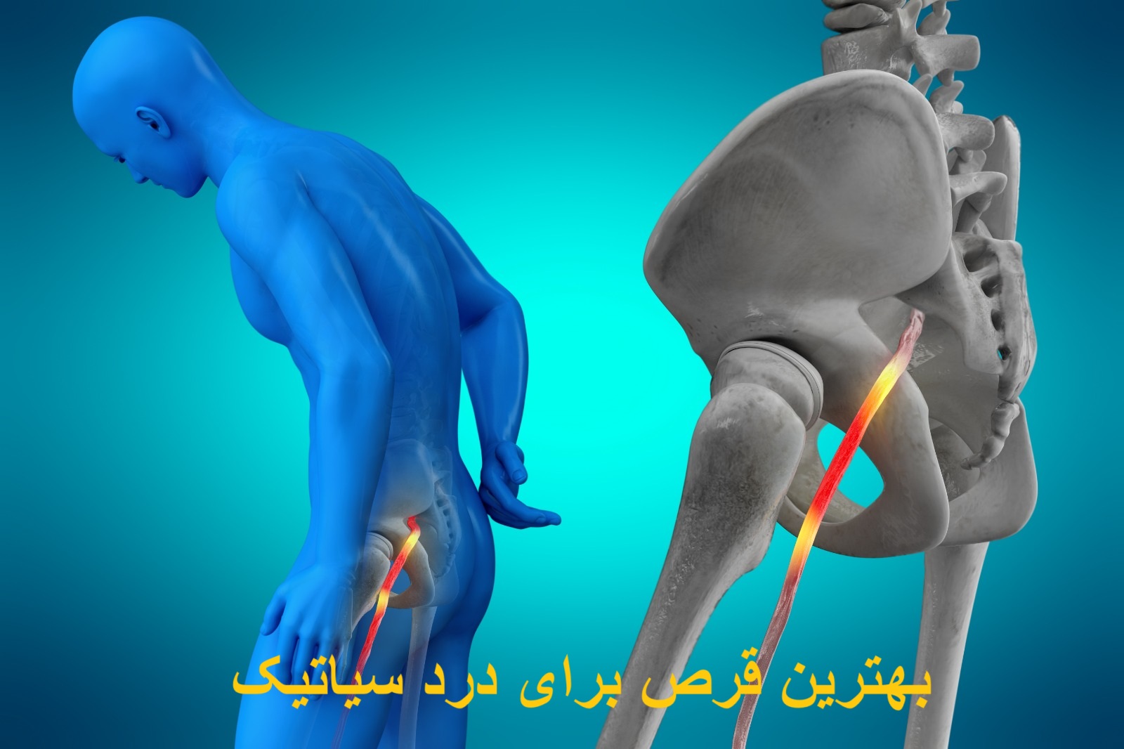 The best pill for sciatica pain