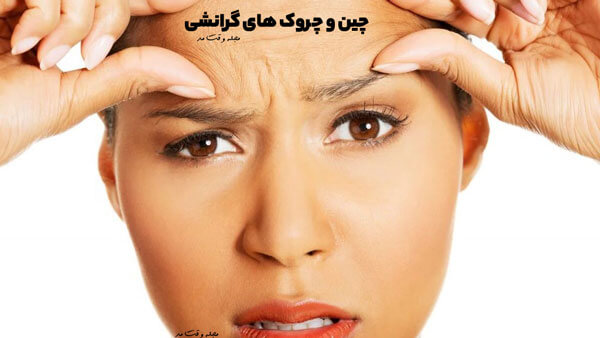 One of the types of wrinkles is gravitational wrinkles that occur naturally over time.
