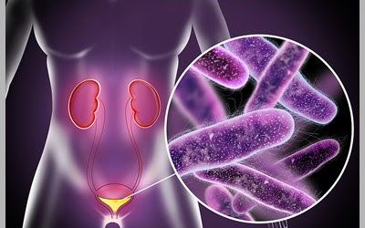 The strongest aibiotics for female urinary tract infection