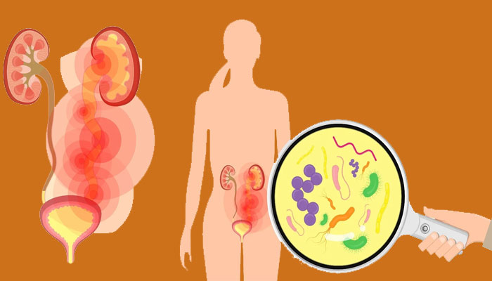 The best medicine for urinary tract infection in women
