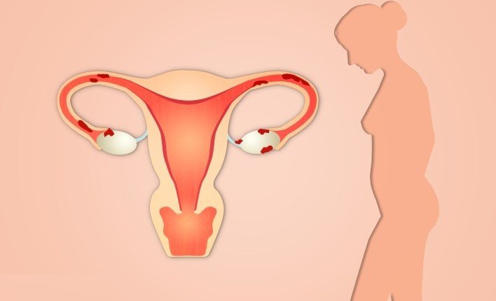 What is a sign of uterine enlargeme?