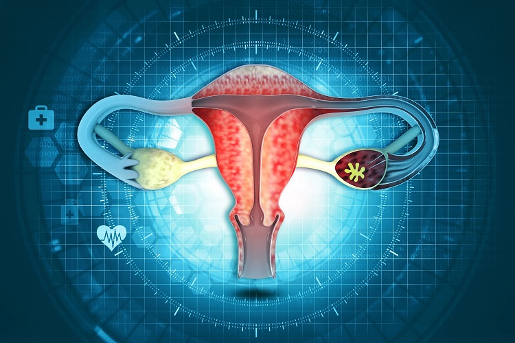 Does the big uterus preve pregnancy?