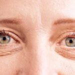 Eyelid drop