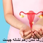 What is the signing of the uterus. What is the sign