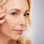 Exercise and Botox