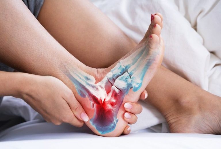 What is the pain of the left heel of the left?