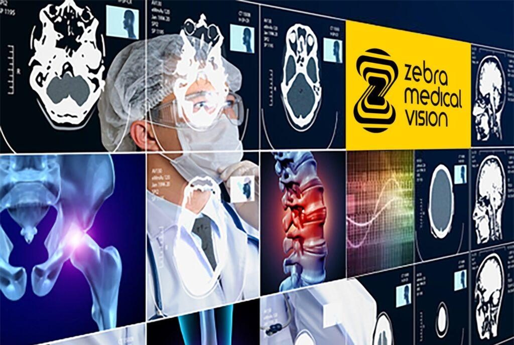 Zebra Medical Vision Best Medical Ielligence