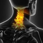 The neck disc