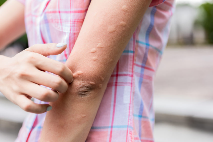 The best aihistamine for the treatme of urticaria