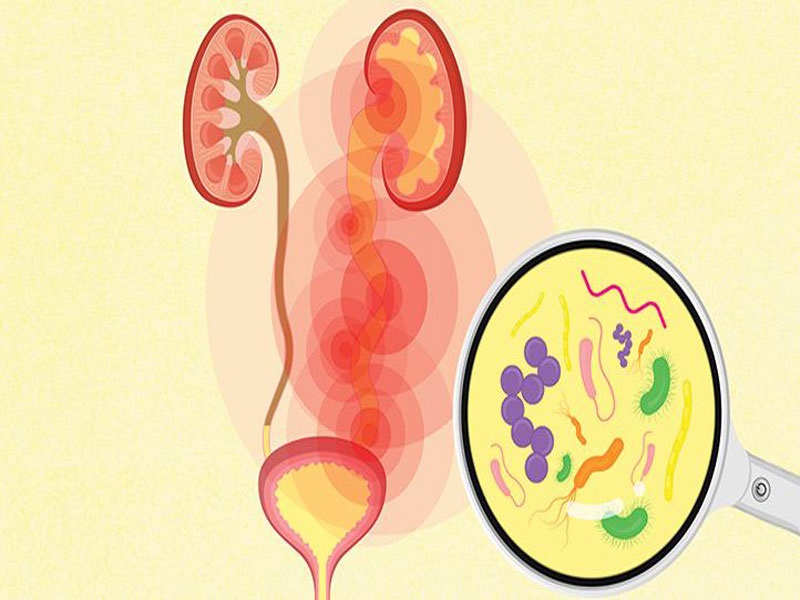 What is the cause of freque urinary tract infection in men?