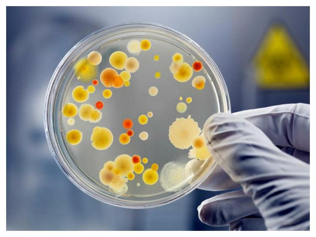 Treatme of men's urinary tract infection at home