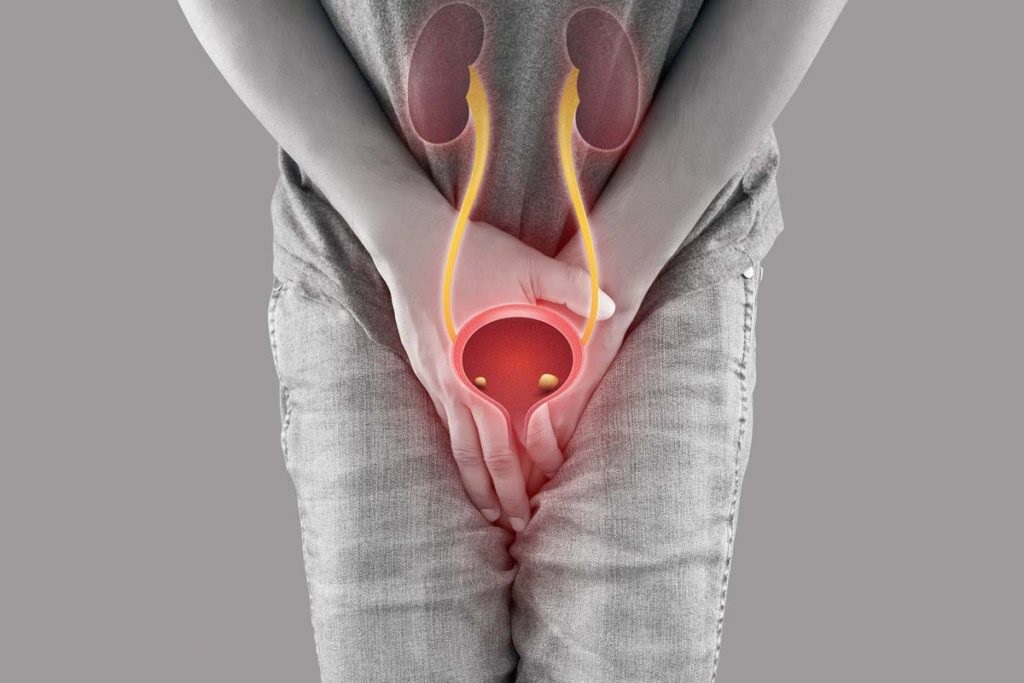 The best medicine for urinary tract infection in men