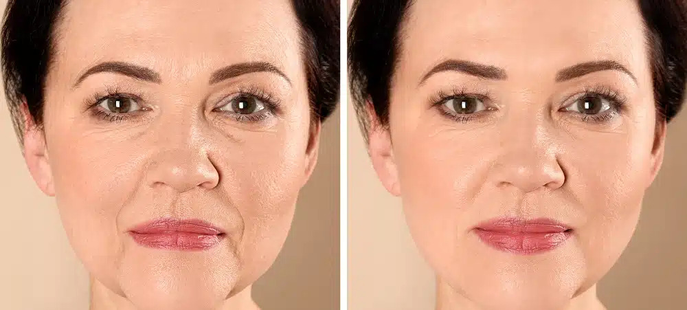 What to eaten to tighten the face of the face