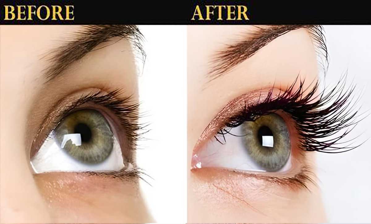 Before and after the use of eyelash amplifier